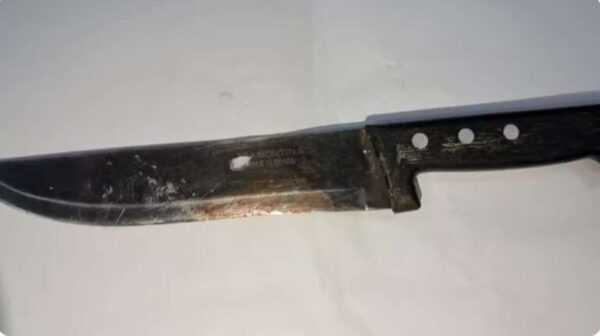 mulher-e-presa-apos-cortar-penis-de-marido-por-“falhar”-na-hora-h